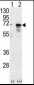 PIAS1 Antibody (N-term)